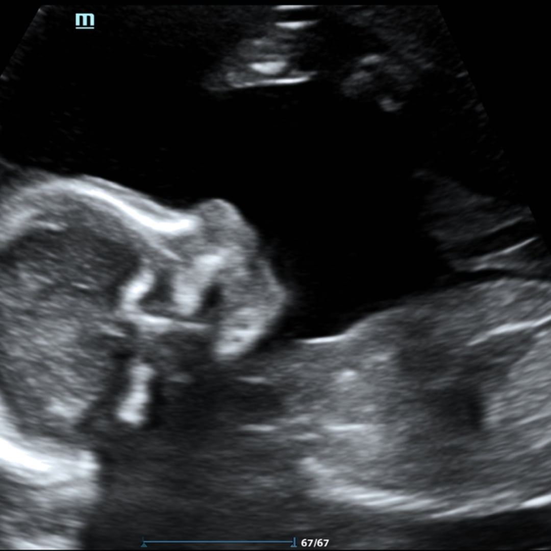 Photo shared by Samantha for their Babylist baby registry.
