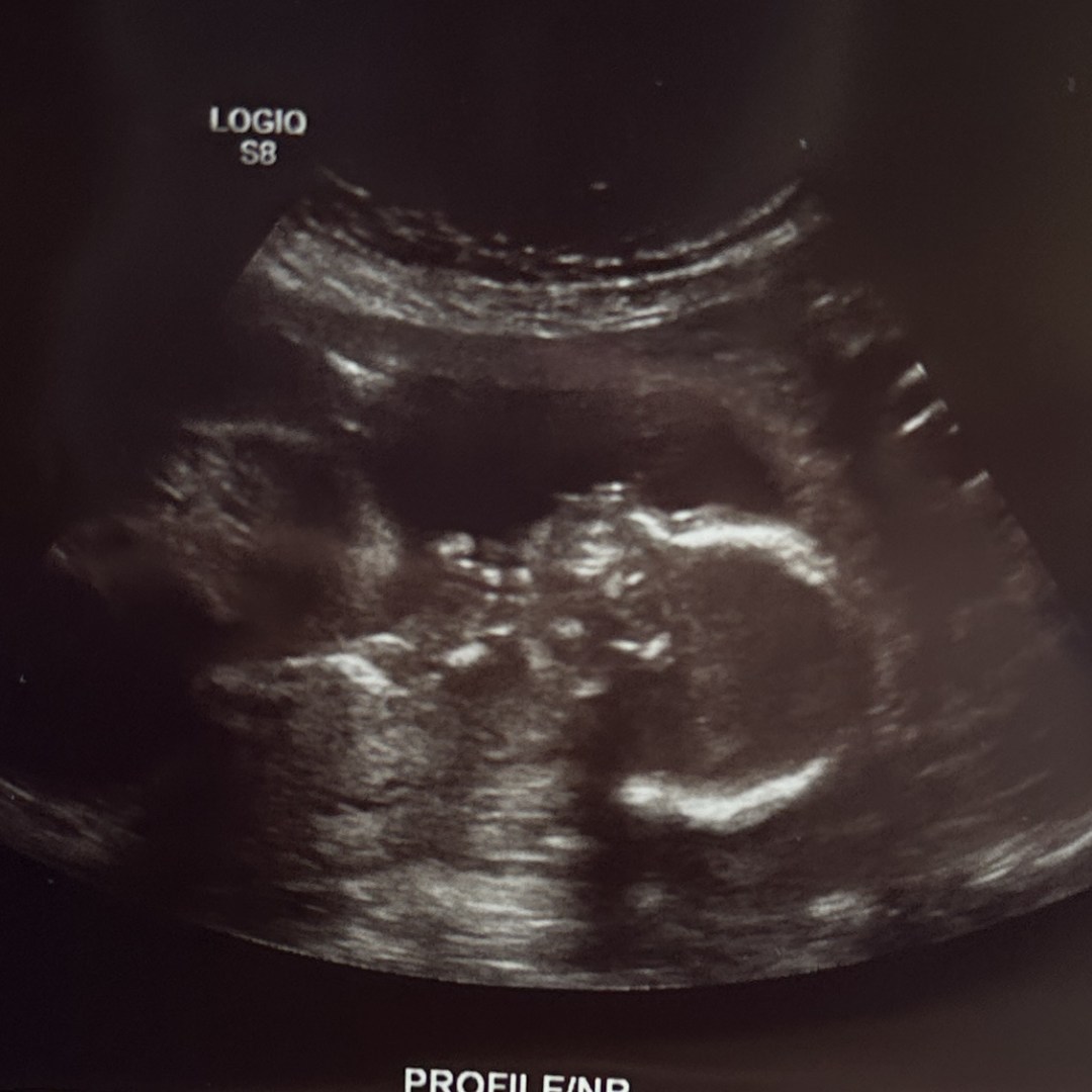 Photo shared by Lily for their Babylist baby registry.