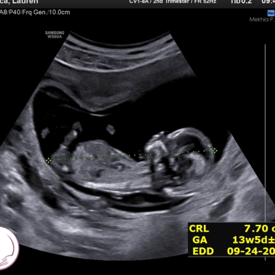 Photo shared by Lauren for their Babylist baby registry.