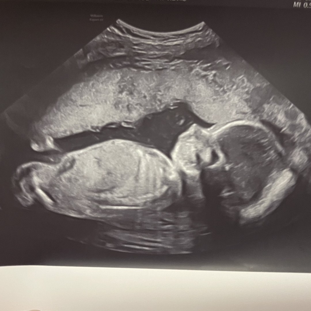 Photo shared by Lindsey for their Babylist baby registry.