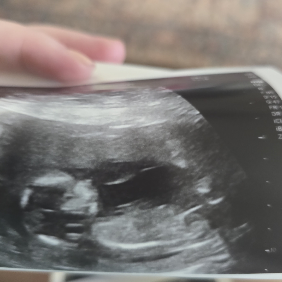 Photo shared by Stephanie for their Babylist baby registry.