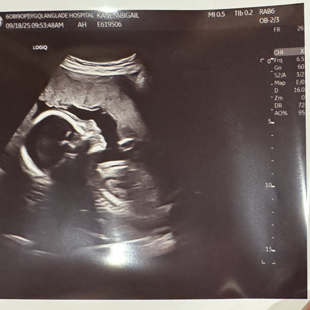 Photo shared by Abby for their Babylist baby registry.
