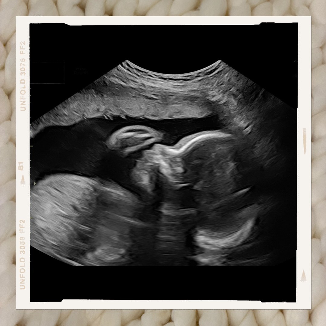 Photo shared by Aryelle for their Babylist baby registry.