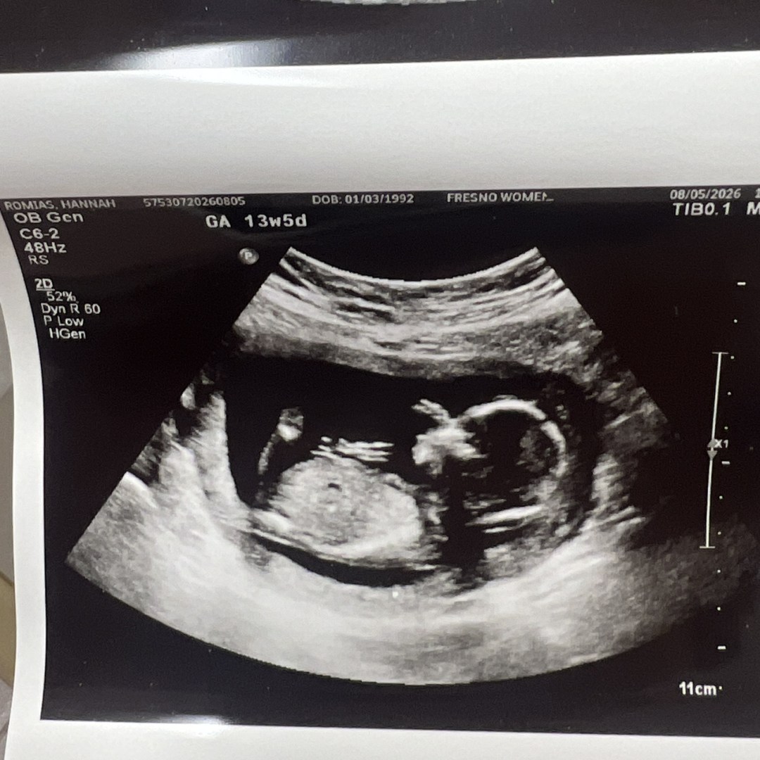 Photo shared by Hannah for their Babylist baby registry.