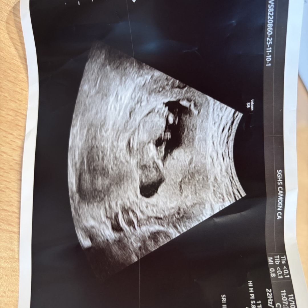 Photo shared by Kaylee for their Babylist baby registry.