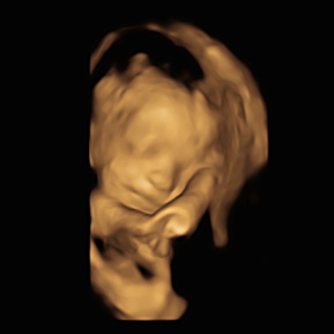 Photo shared by Cassidy for their Babylist baby registry.