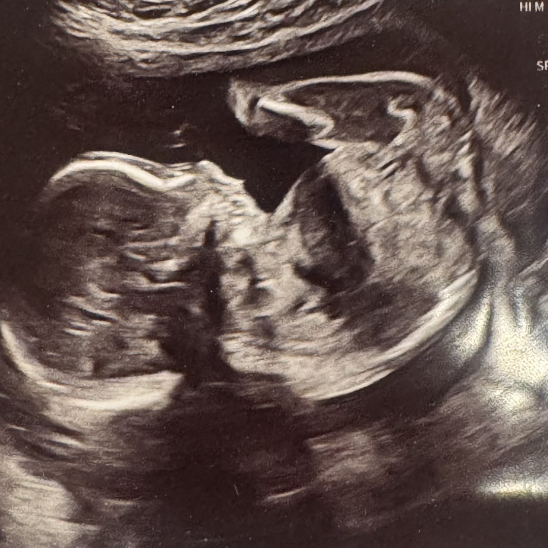 Photo shared by Brittany for their Babylist baby registry.