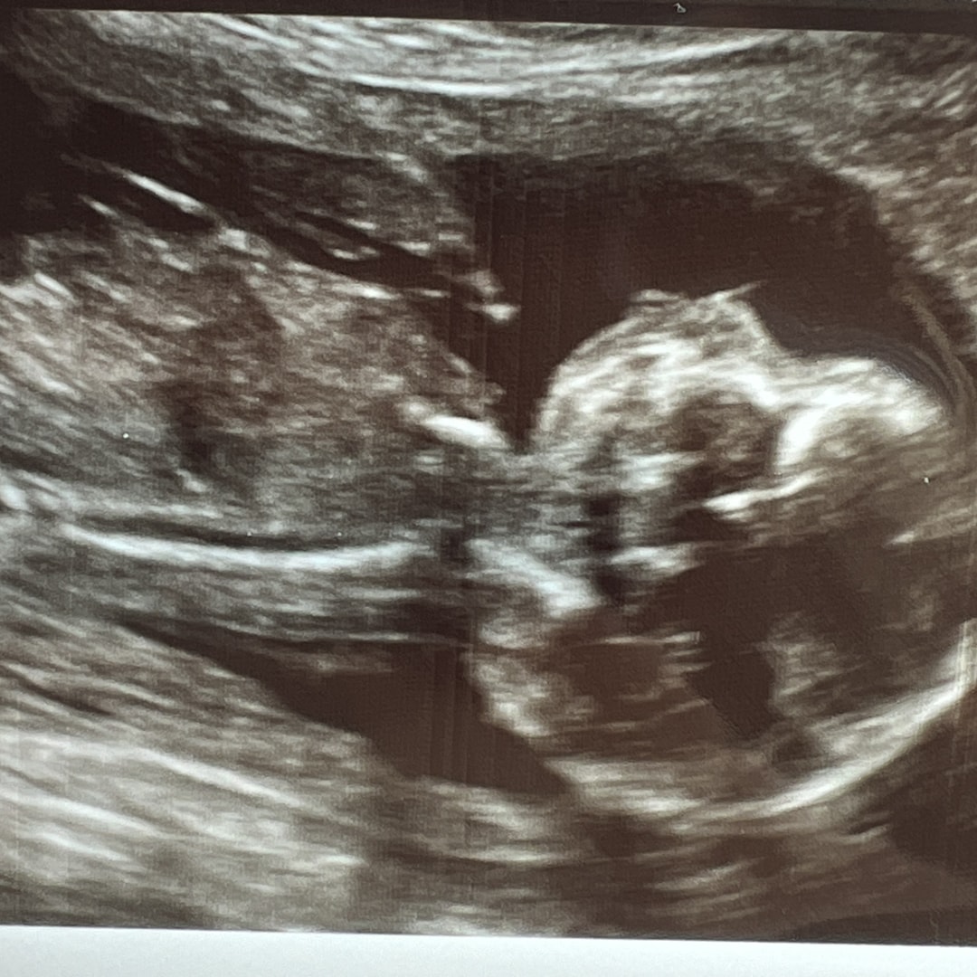 Photo shared by Andrea for their Babylist baby registry.