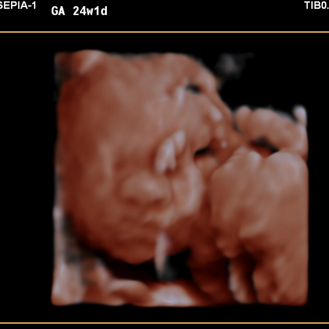 Photo shared by Hayden for their Babylist baby registry.