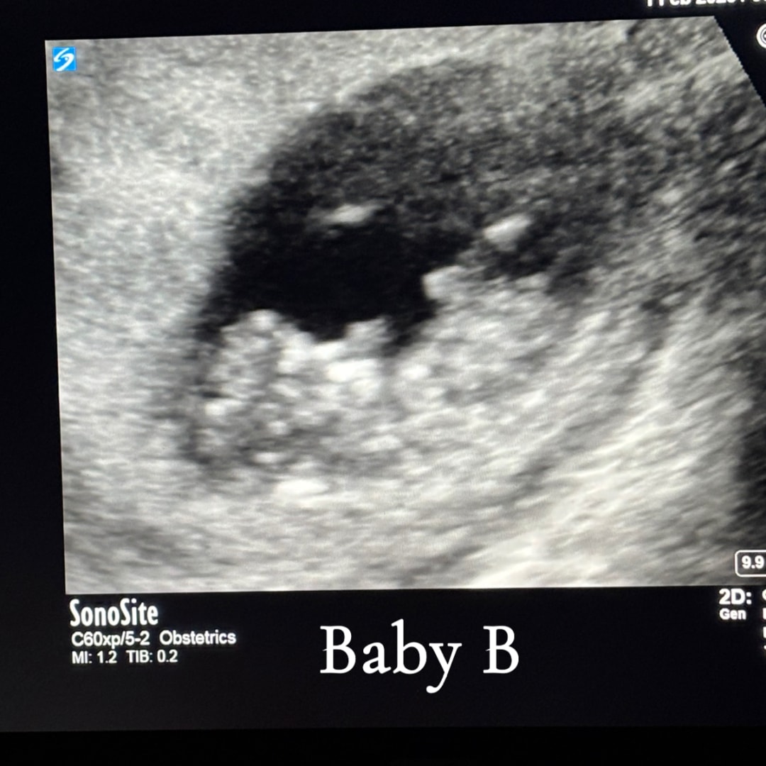 Photo shared by Hilarie for their Babylist baby registry.