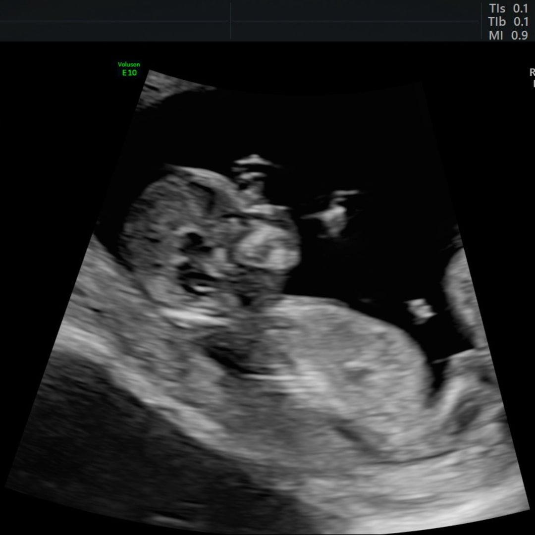 Photo shared by Chelsea for their Babylist baby registry.