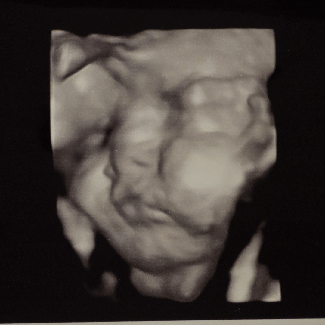 Photo shared by Josie for their Babylist baby registry.