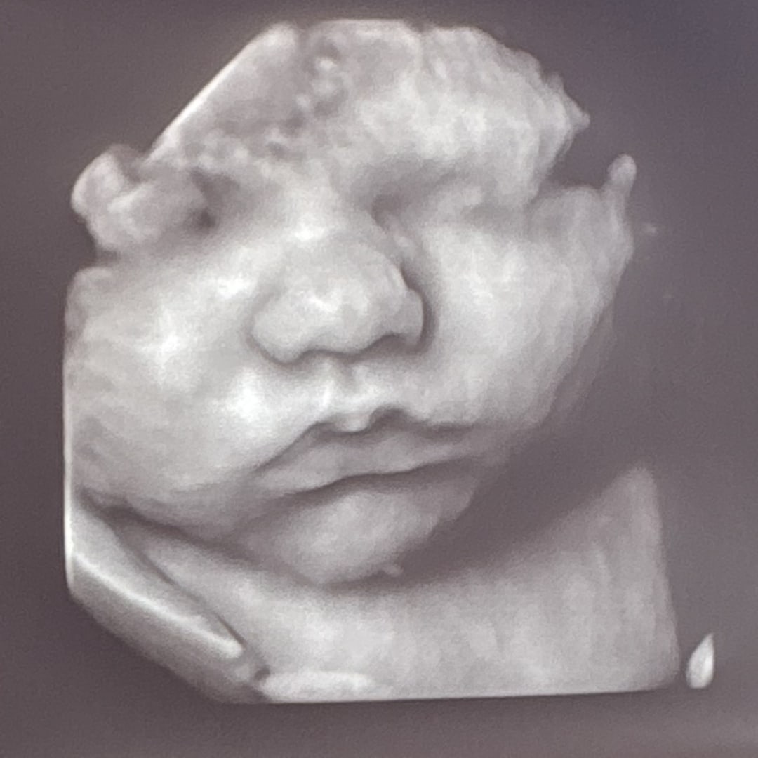 Photo shared by Analese for their Babylist baby registry.