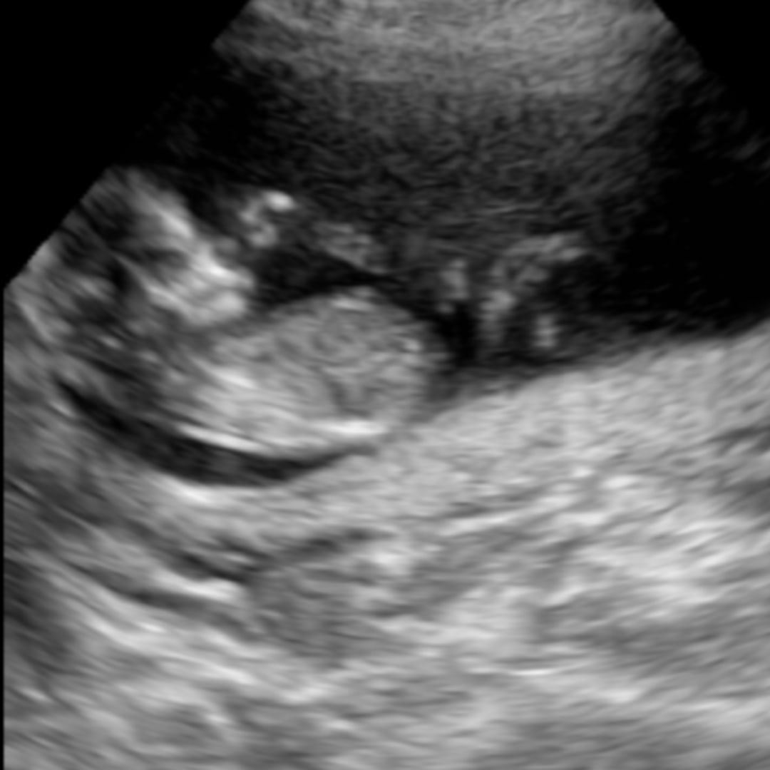 Photo shared by Katelyn for their Babylist baby registry.