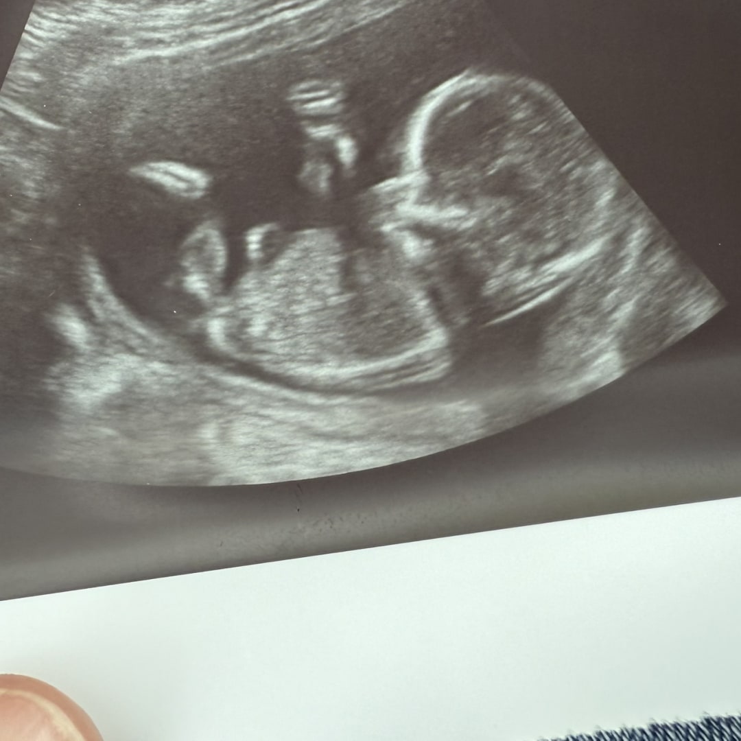 Photo shared by Kendra for their Babylist baby registry.