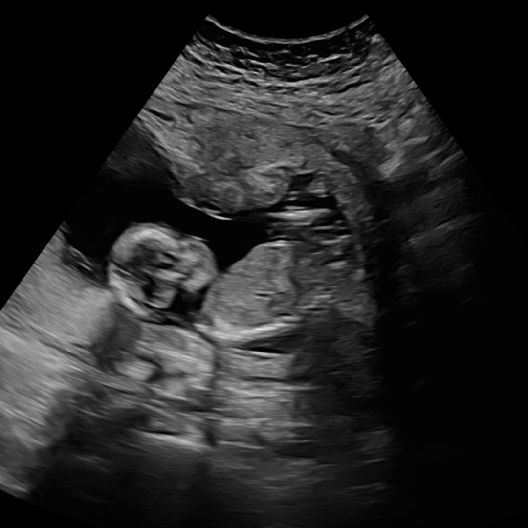 Photo shared by Hannah for their Babylist baby registry.