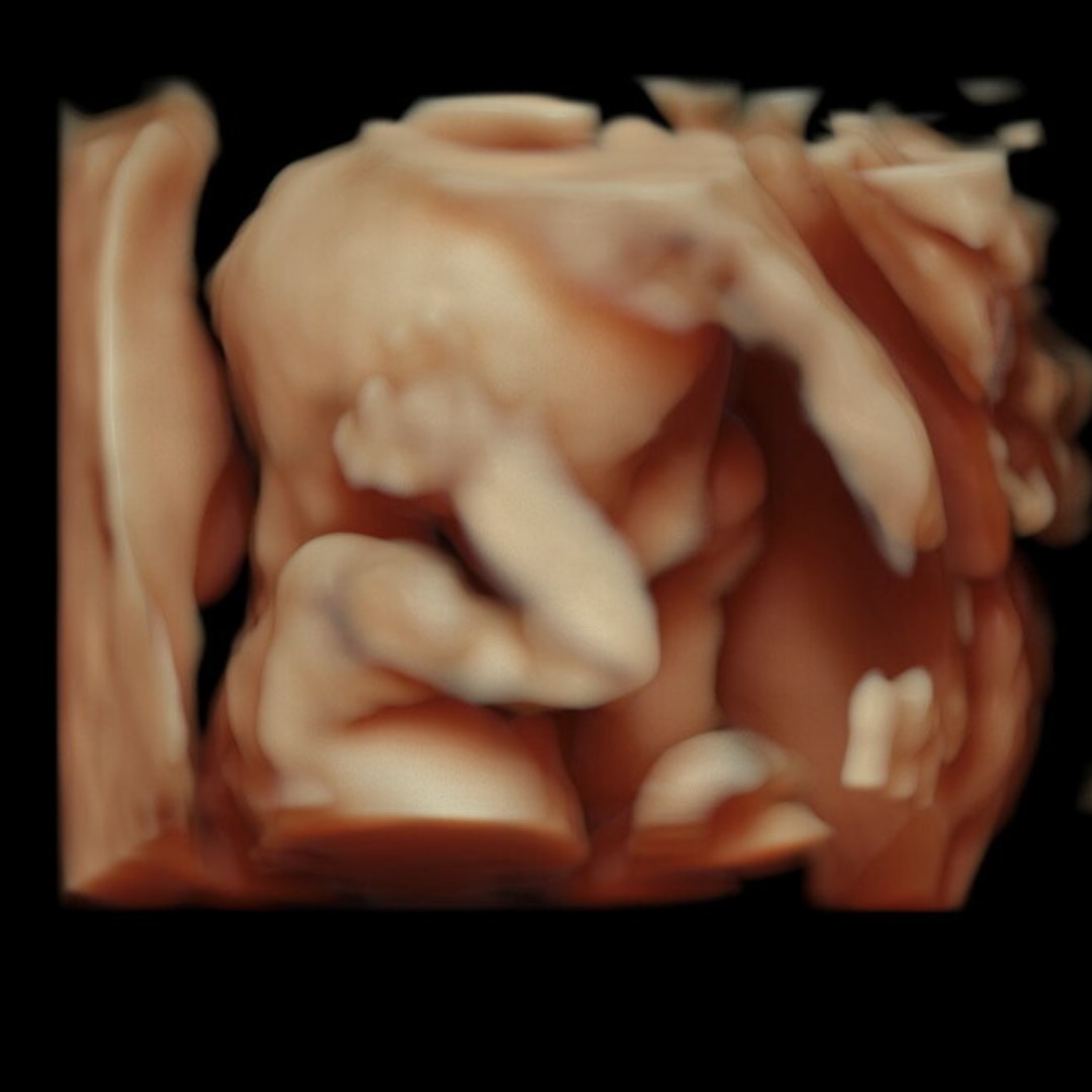 Photo shared by Maddie for their Babylist baby registry.