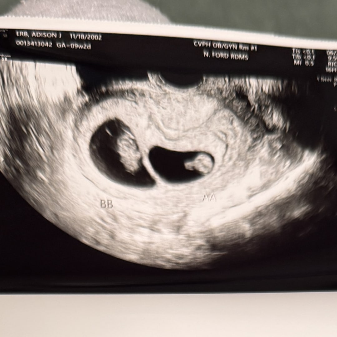Photo shared by Adison for their Babylist baby registry.