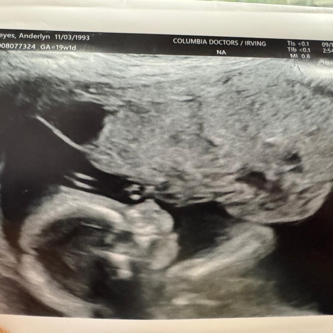 Photo shared by Anderlyn for their Babylist baby registry.