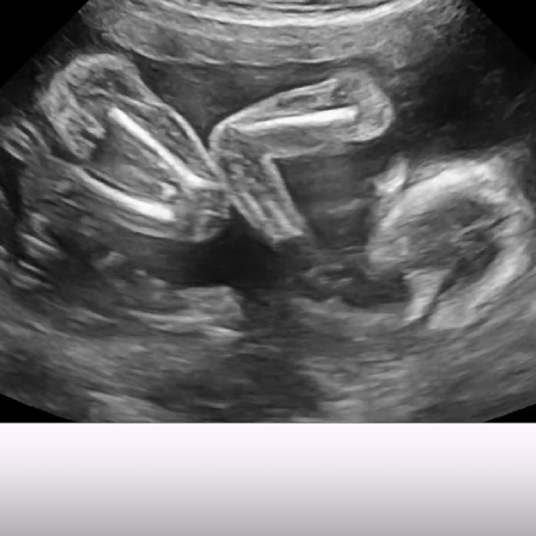 Photo shared by Audrey for their Babylist baby registry.