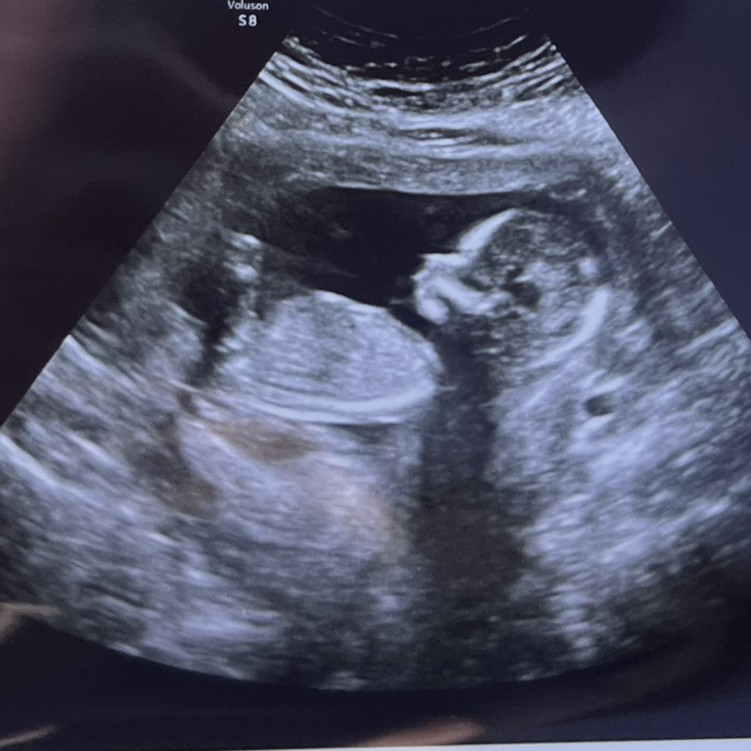 Photo shared by Cindy for their Babylist baby registry.