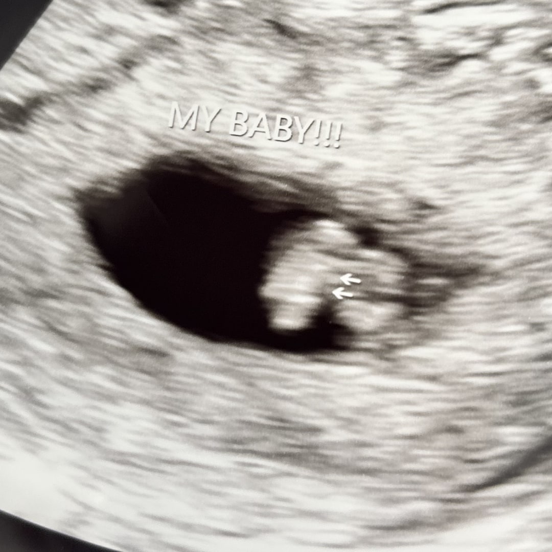 Photo shared by Jestine for their Babylist baby registry.