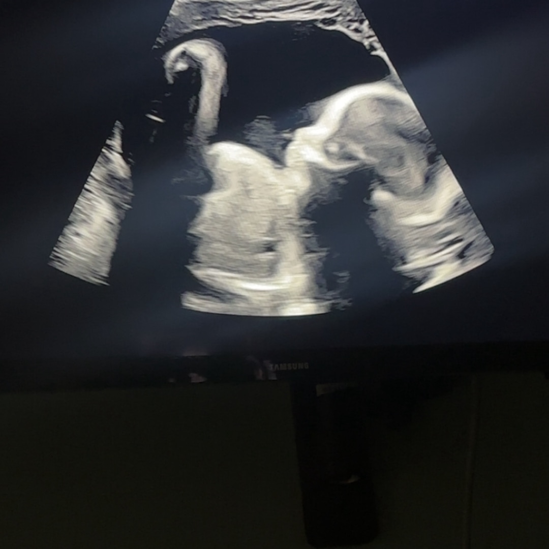 Photo shared by Dina for their Babylist baby registry.