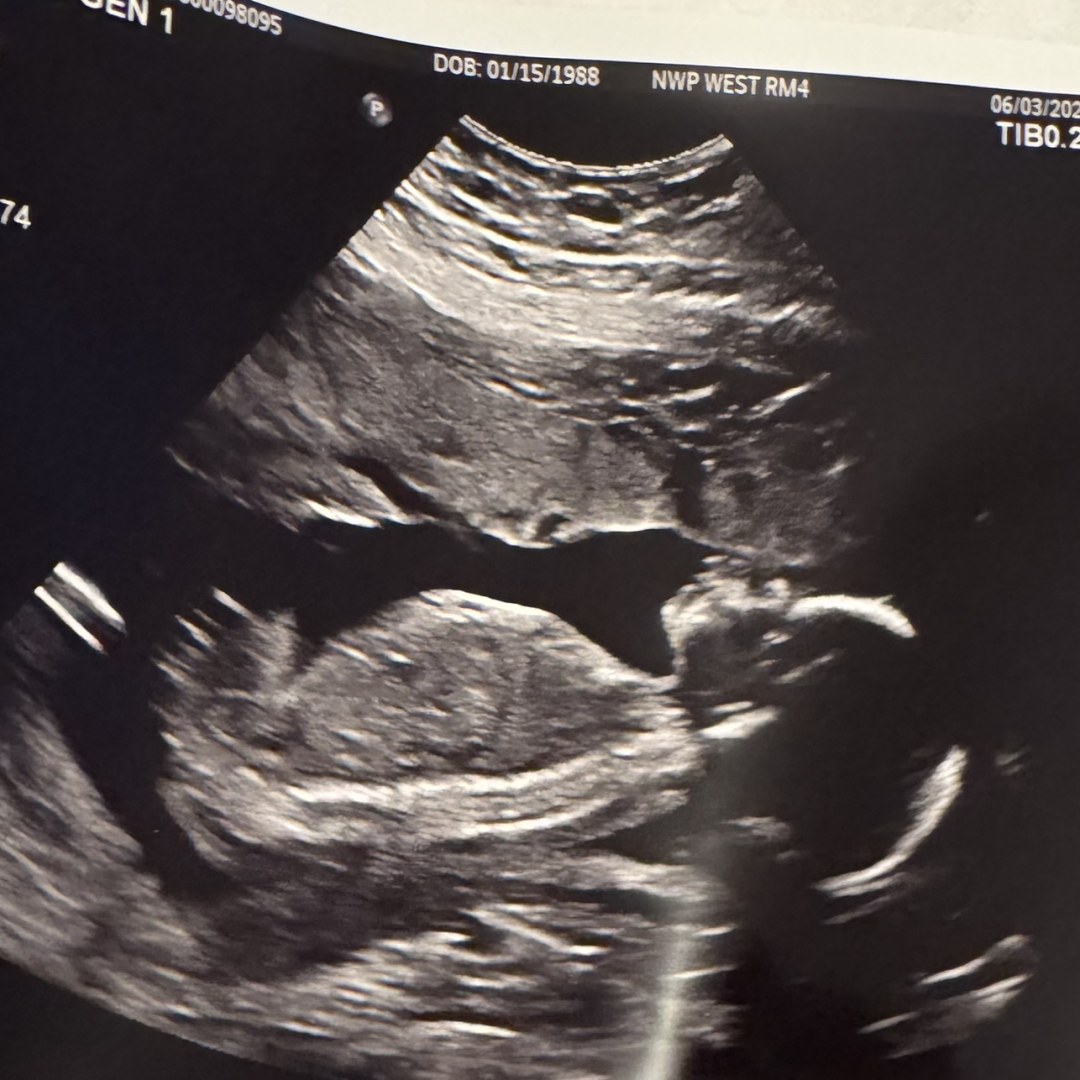 Photo shared by Jenna for their Babylist baby registry.
