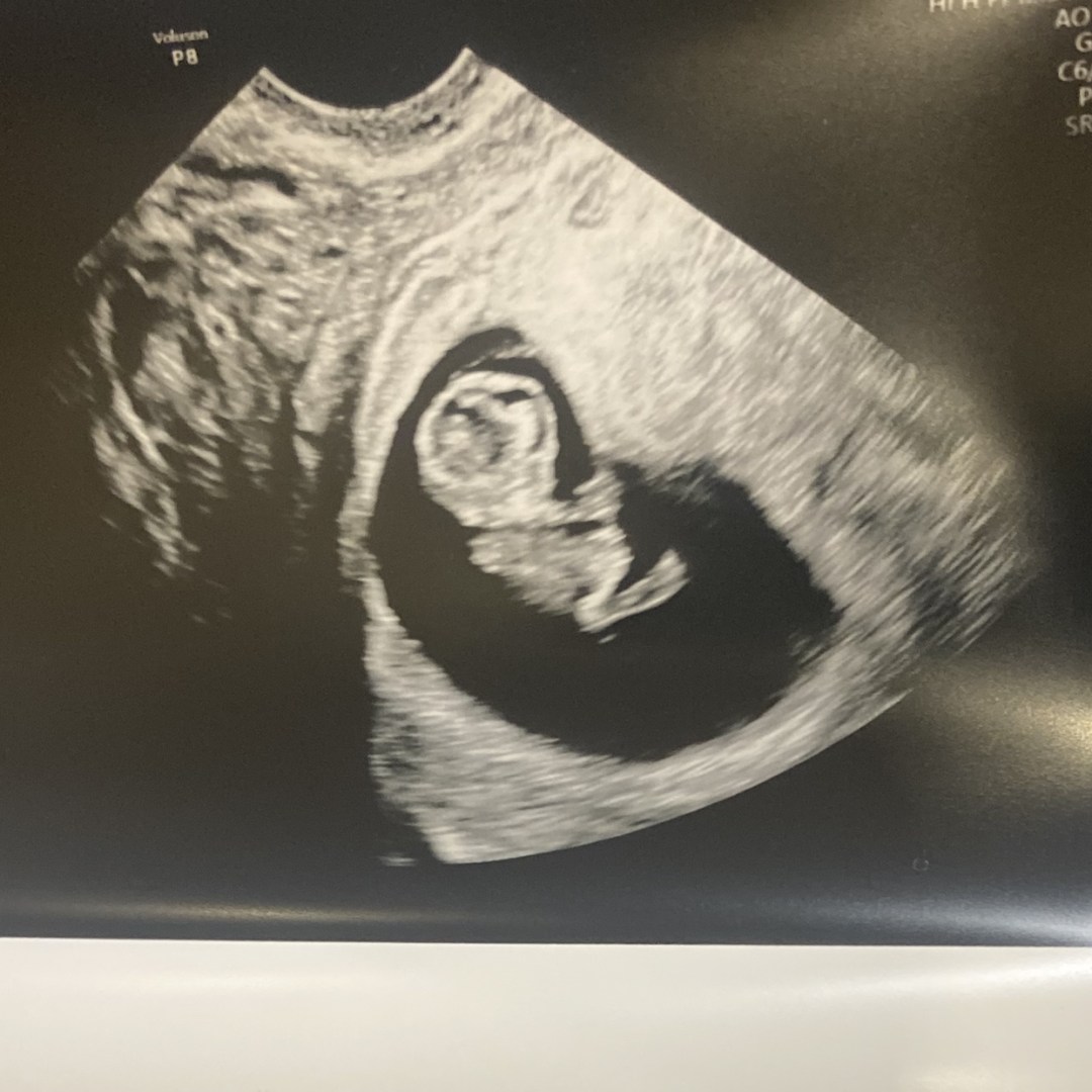 Photo shared by De’Nique for their Babylist baby registry.