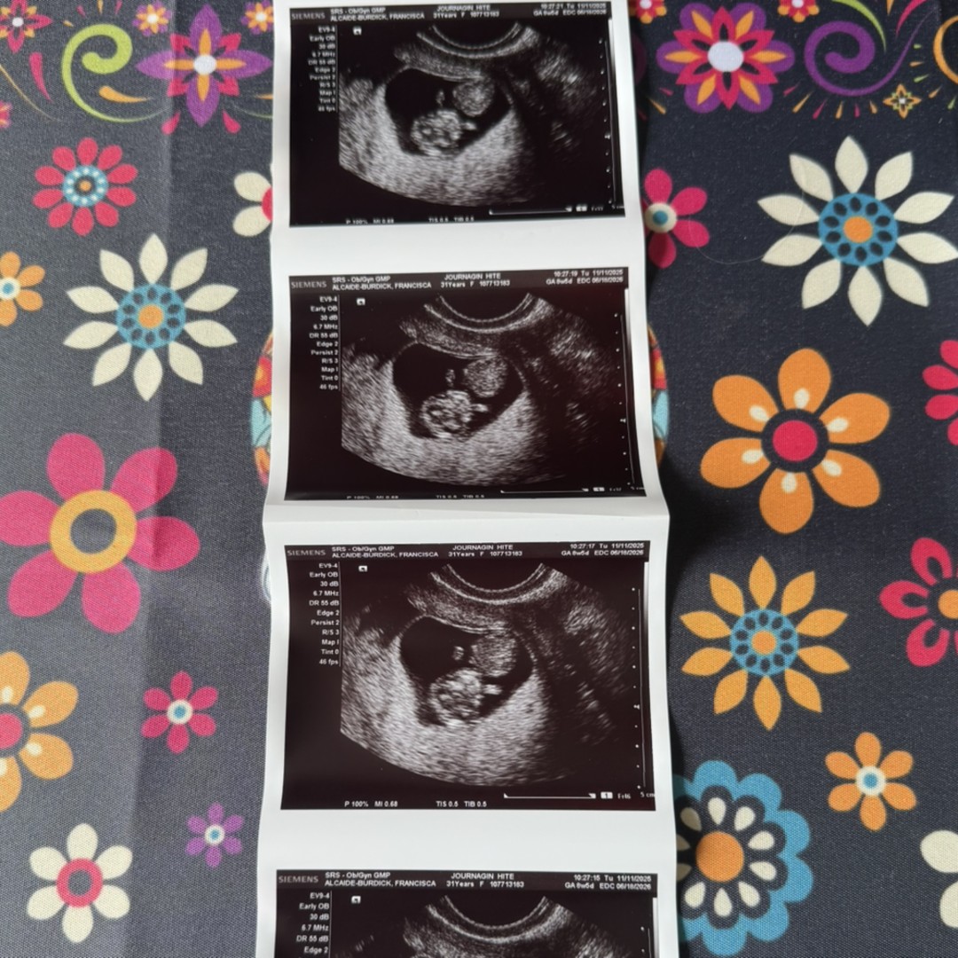 Photo shared by Francisca for their Babylist baby registry.