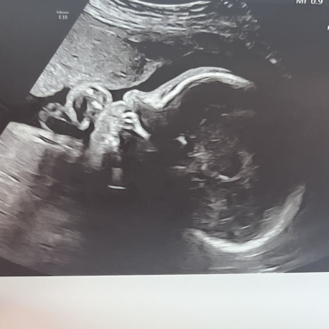 Photo shared by Cecille for their Babylist baby registry.