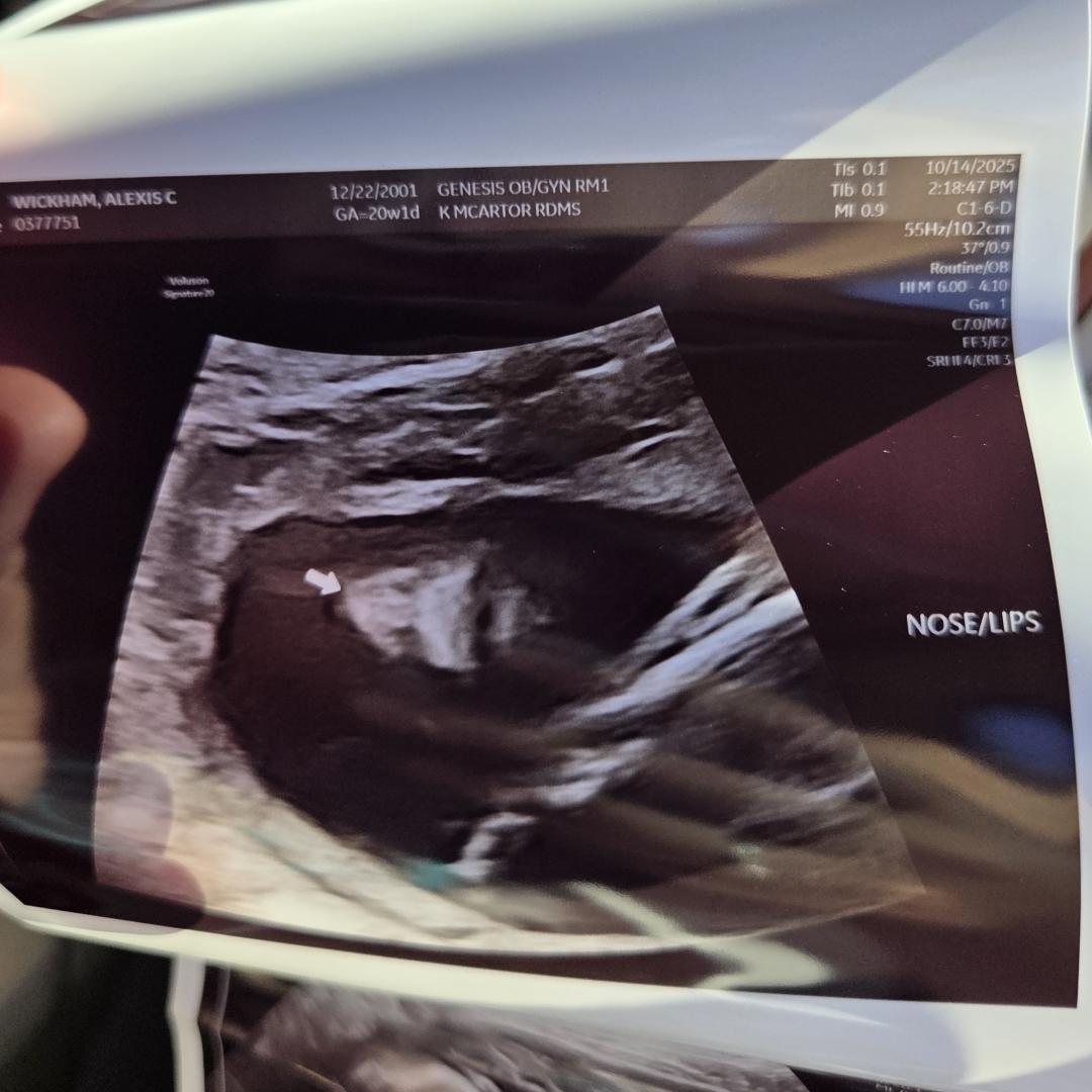 Photo shared by Alexis for their Babylist baby registry.