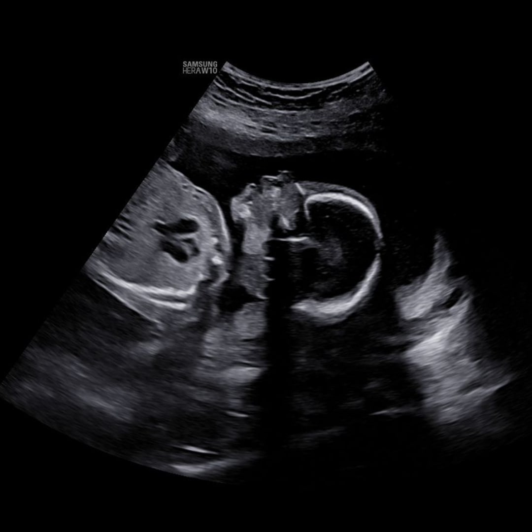 Photo shared by Lilly for their Babylist baby registry.