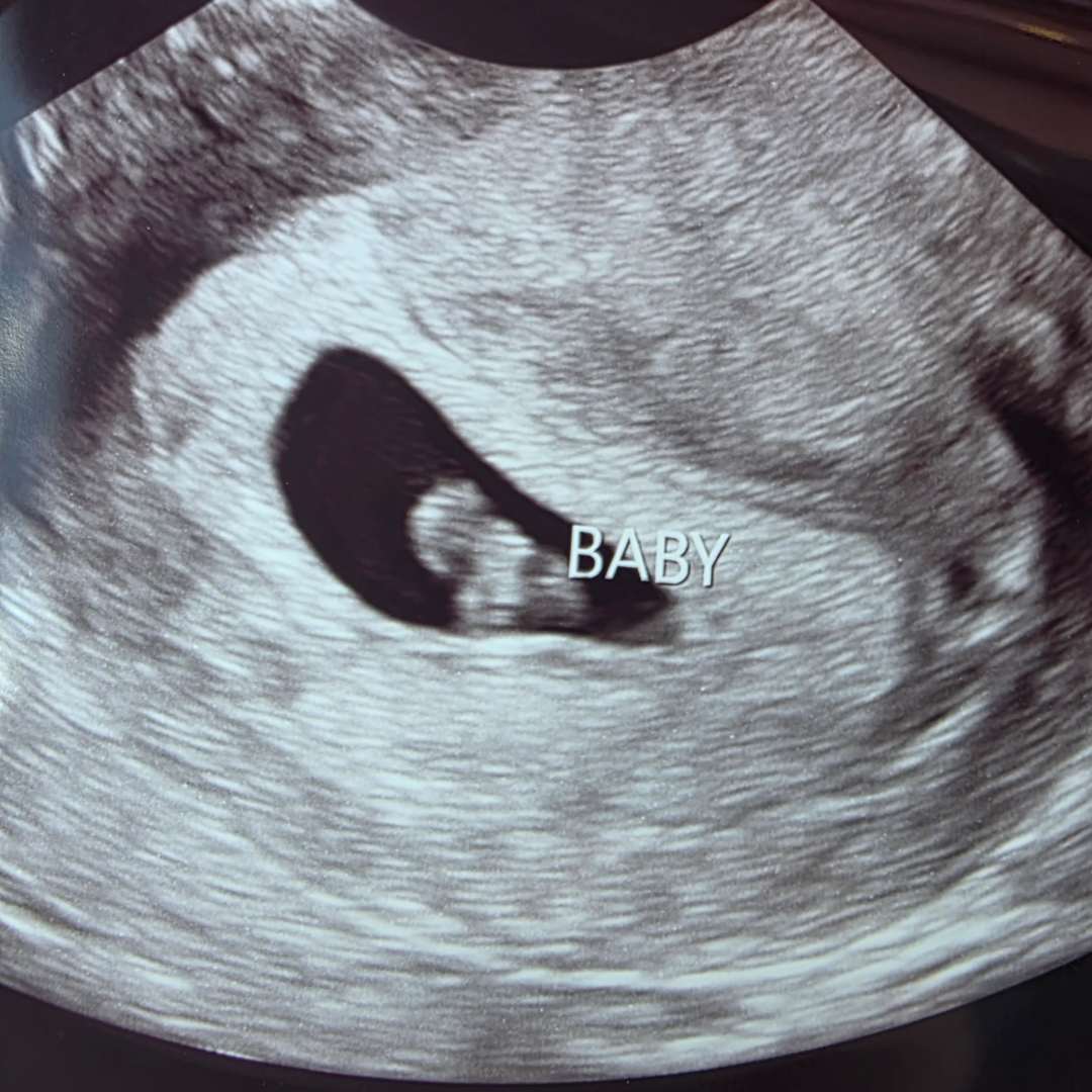 Photo shared by Natalie for their Babylist baby registry.
