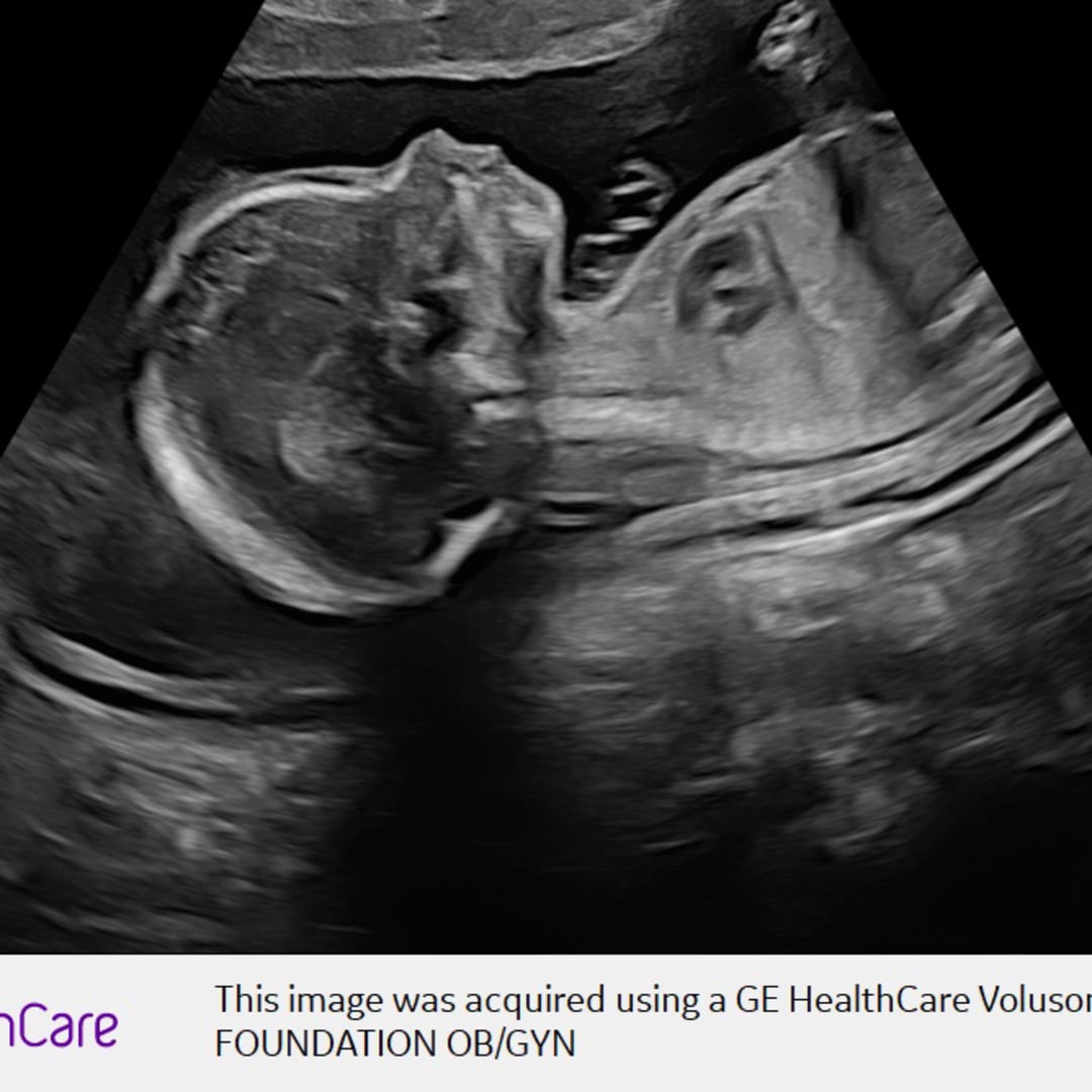 Photo shared by Hope for their Babylist baby registry.