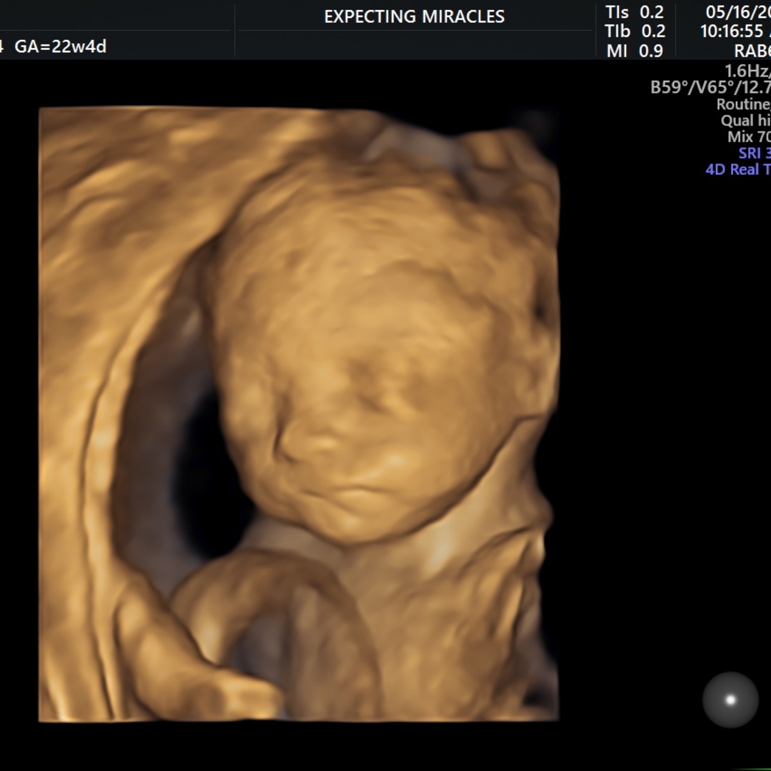 Photo shared by Ciera for their Babylist baby registry.