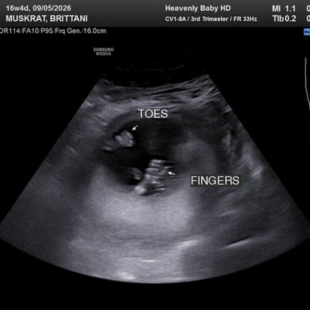 Photo shared by Brittani for their Babylist baby registry.