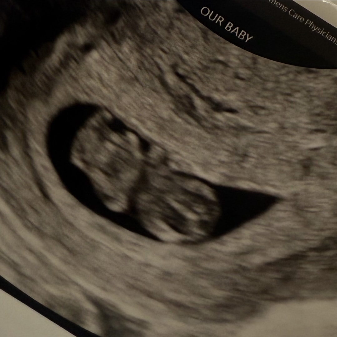 Photo shared by Kalee for their Babylist baby registry.