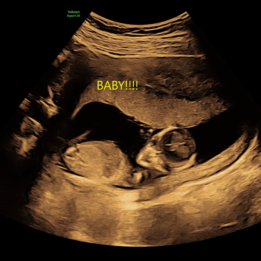 Photo shared by Alysa for their Babylist baby registry.