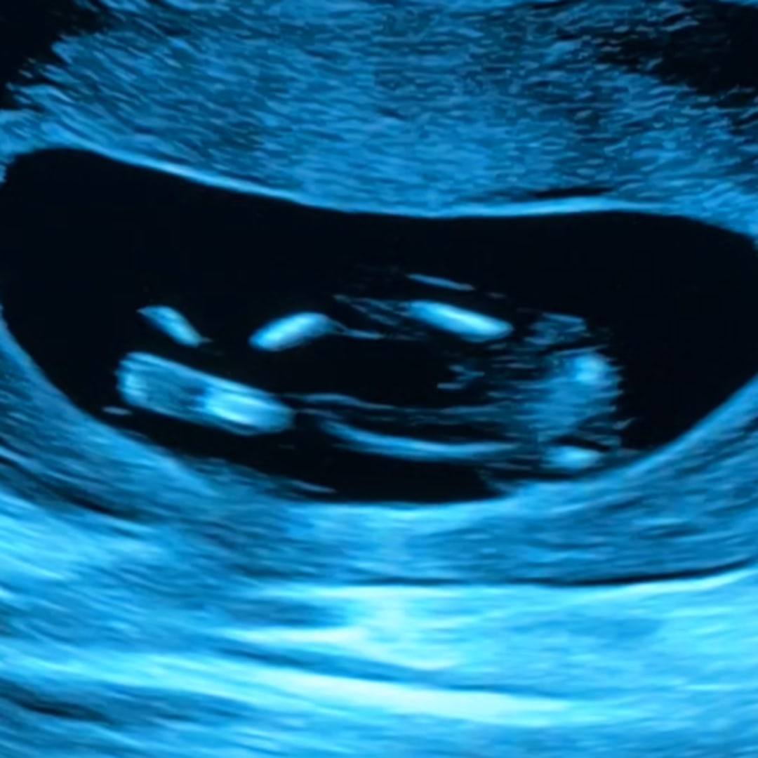 Photo shared by Becca for their Babylist baby registry.
