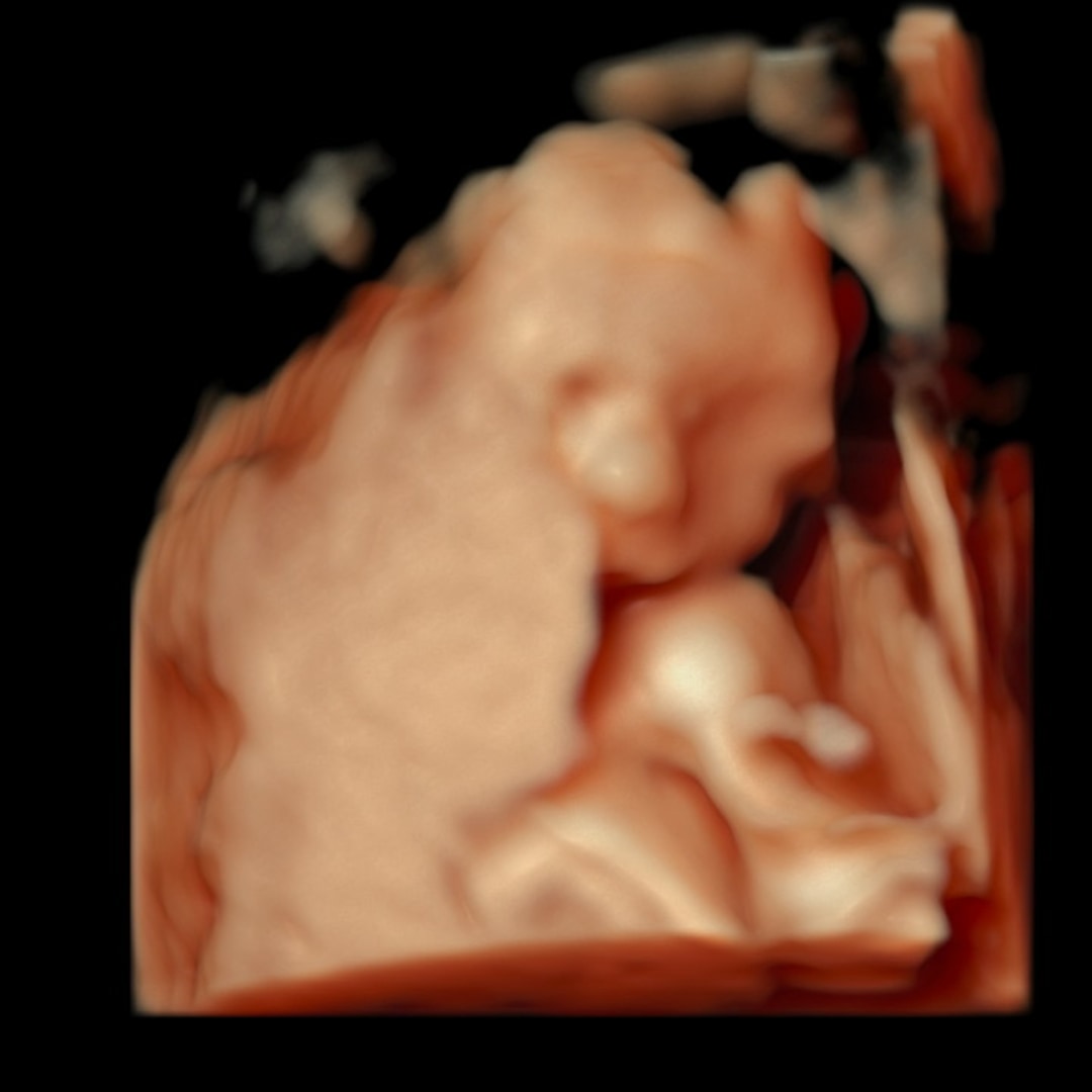 Photo shared by Citlaly for their Babylist baby registry.