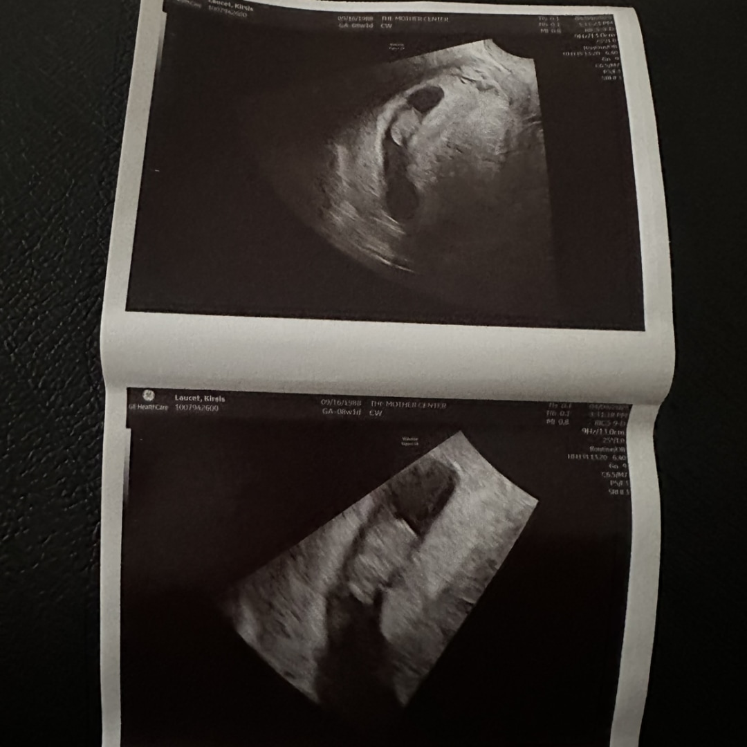 Photo shared by Kirsis for their Babylist baby registry.