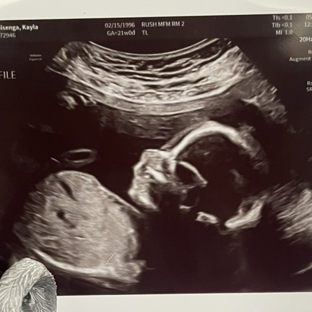 Photo shared by Kayla for their Babylist baby registry.