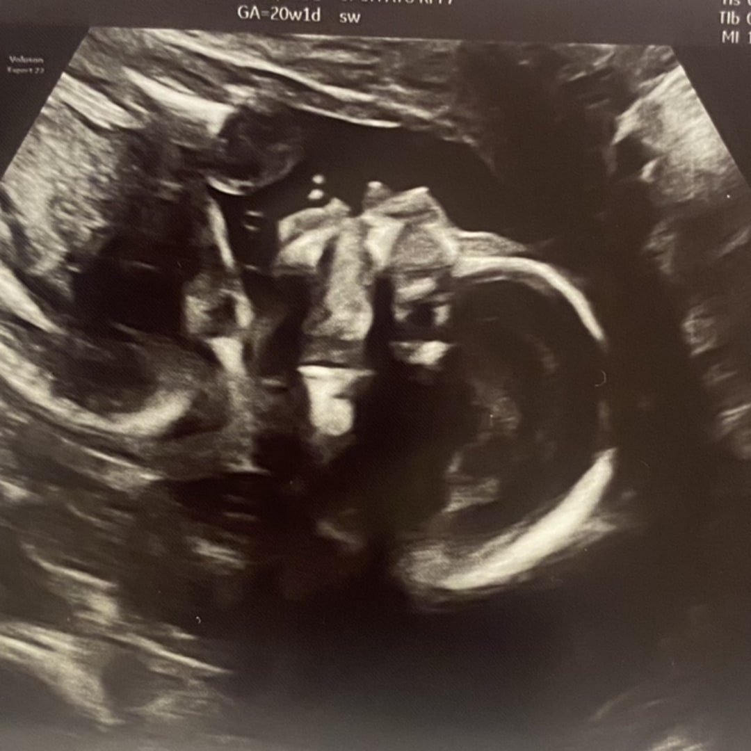 Photo shared by Michelle for their Babylist baby registry.