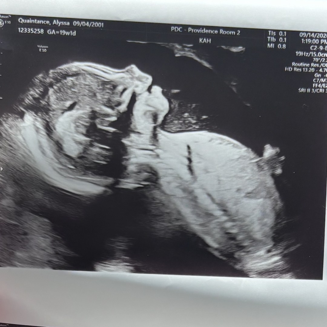 Photo shared by Alyssa for their Babylist baby registry.