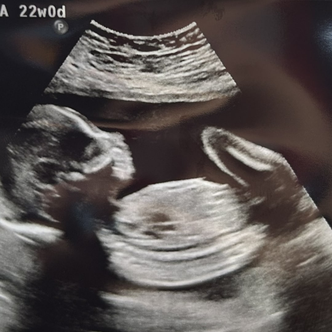 Photo shared by Josefina for their Babylist baby registry.
