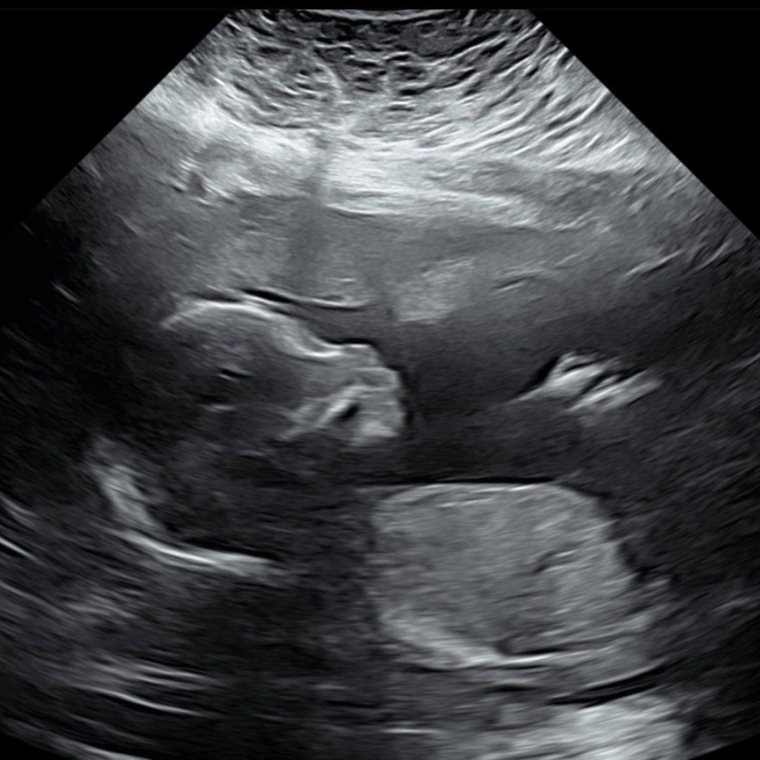 Photo shared by Annissa for their Babylist baby registry.