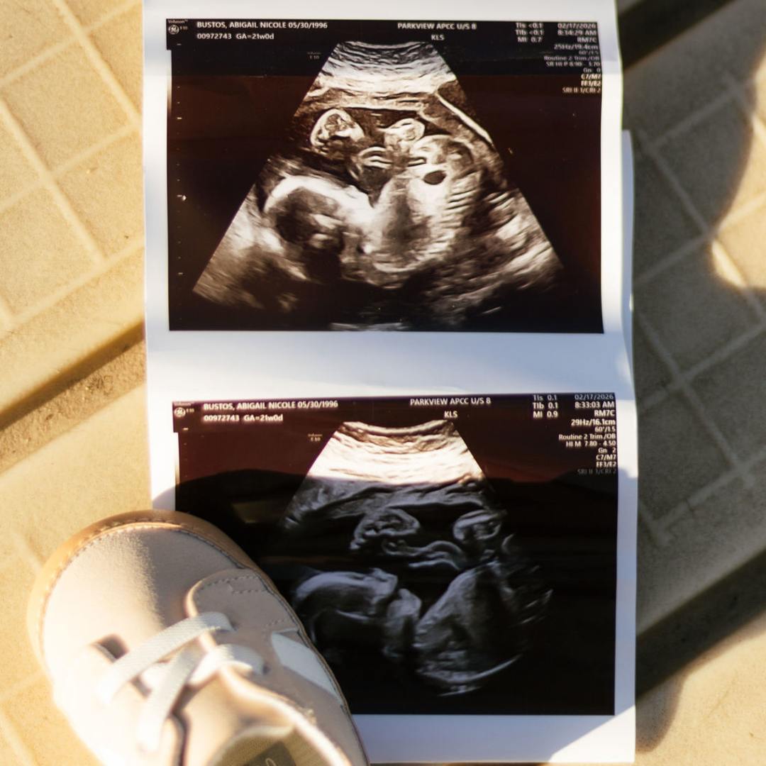 Photo shared by Abigail for their Babylist baby registry.