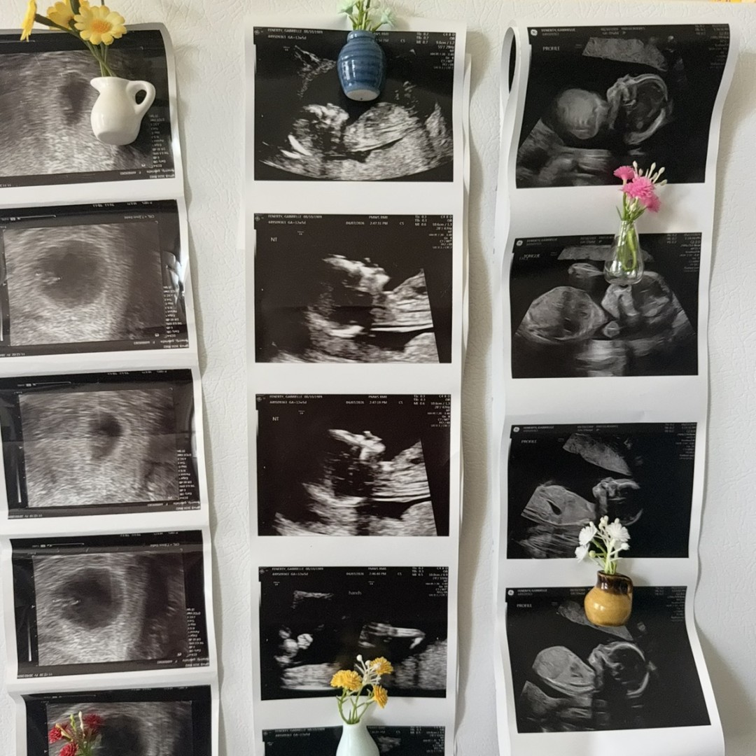 Photo shared by Gabrielle for their Babylist baby registry.