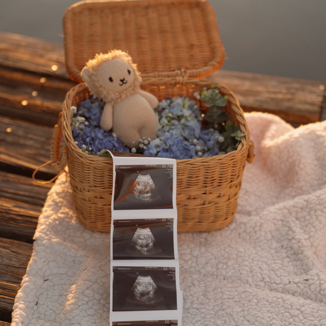 Photo shared by Rainer for their Babylist baby registry.